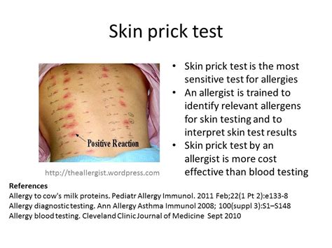 scratch test scale|skin prick test results chart.